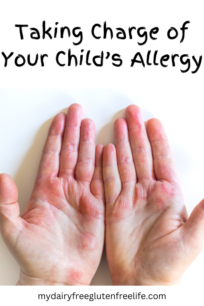 Taking Charge of your child's allergy