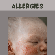 Top 5 Food Allergies